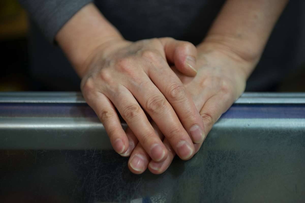 Sve što trebate znati o Parkinsonovoj bolesti