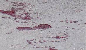 Požežanka N.O.(50)  brutalno pretučena pred Pubom, policija otkrila neočekivani obrat u priči