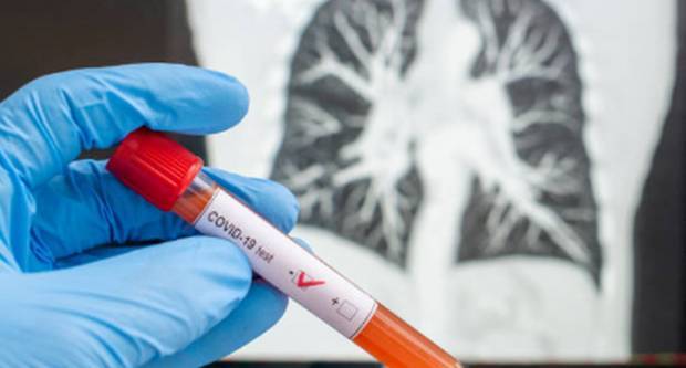 Jedan novi slučaj koronavirusa u posljednja 24 sata 