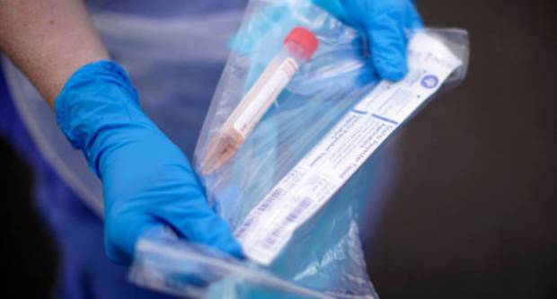 57 novih slučajeva koronavirusa u protekla 24 sata, u bolnicama ukupno 93 osoba