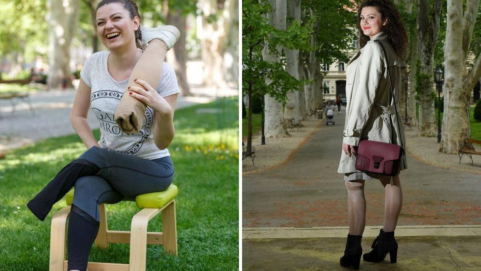Požežanka Anja nije odustala: ʺIako su mi amputirali nogu, nosim štikleʺ